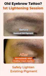 Why Should You Lighten Old Eyebrow Tattoo Pigment Before New Eyebrow Tattoo?