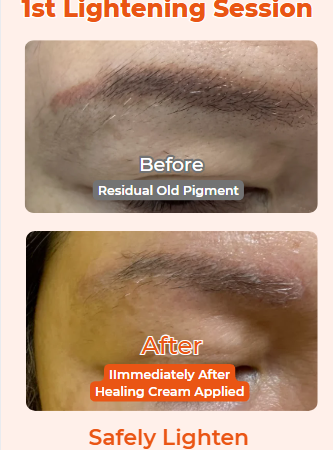 Why Should You Lighten Old Eyebrow Tattoo Pigment Before New Eyebrow Tattoo?